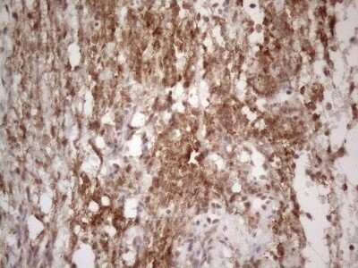 Immunohistochemistry: TR4/NR2C2 Antibody (OTI4B1) - Azide and BSA Free [NBP2-74577]