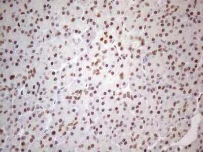 Immunohistochemistry: TR4/NR2C2 Antibody (OTI4B1) - Azide and BSA Free [NBP2-74577]