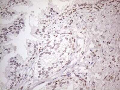 Immunohistochemistry: TR4/NR2C2 Antibody (OTI4B1) - Azide and BSA Free [NBP2-74577]