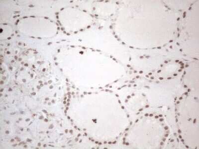 Immunohistochemistry: TR4/NR2C2 Antibody (OTI4B1) - Azide and BSA Free [NBP2-74577]