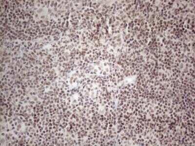 Immunohistochemistry: TR4/NR2C2 Antibody (OTI4B1) - Azide and BSA Free [NBP2-74577]