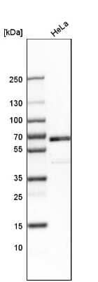 Western Blot: TR4/NR2C2 Antibody [NBP1-81658]