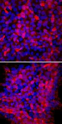 Immunocytochemistry/ Immunofluorescence: TRA-1-60(R) Antibody (TRA-1-60) [NB100-730]