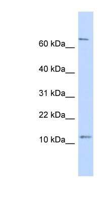 Western Blot: TRA16 Antibody [NBP1-56746]