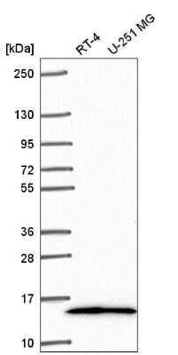 Western Blot: TRA16 Antibody [NBP2-55864]