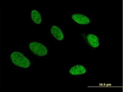 Immunocytochemistry/ Immunofluorescence: TRA2A Antibody [H00029896-B01P]