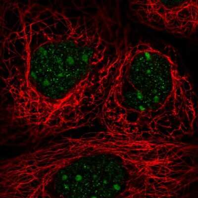 Immunocytochemistry/ Immunofluorescence: TRA2A Antibody [NBP2-13473]