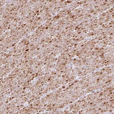 Immunohistochemistry-Paraffin: TRA2A Antibody [NBP2-13473]