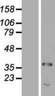 Western Blot: TRA2A Overexpression Lysate [NBL1-17237]