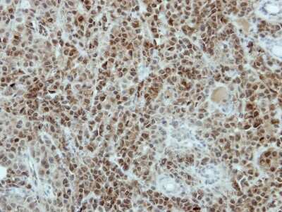 Immunohistochemistry-Paraffin: TRA2B Antibody [NBP2-15143]