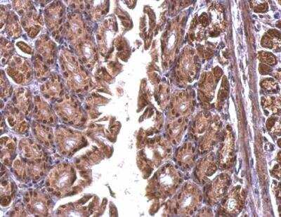 Immunohistochemistry-Paraffin: TRA2B Antibody [NBP2-15143]