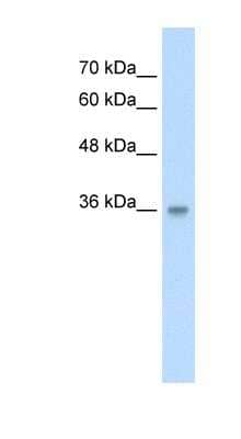 Western Blot: TRABD Antibody [NBP1-70734]