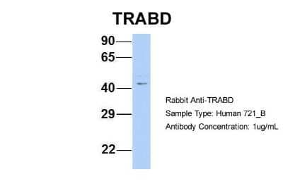 Western Blot: TRABD Antibody [NBP2-86870]
