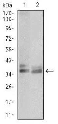 Western Blot: TRACP/PAP/ACP5 Antibody (5C5E7)BSA Free [NBP2-37362]