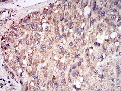 Immunohistochemistry: TRACP/PAP/ACP5 Antibody (7E6A11) - BSA Free [NBP2-37337]