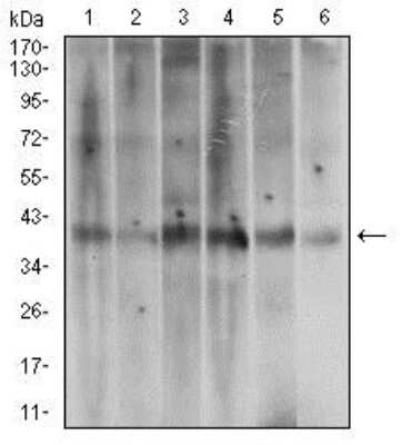 Western Blot: TRACP/PAP/ACP5 Antibody (7E6A11)BSA Free [NBP2-37337]