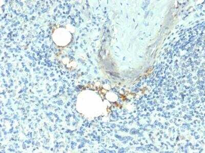 Immunohistochemistry-Paraffin: TRACP/PAP/ACP5 Antibody (ACP5/1070) - Azide and BSA Free [NBP2-47666]