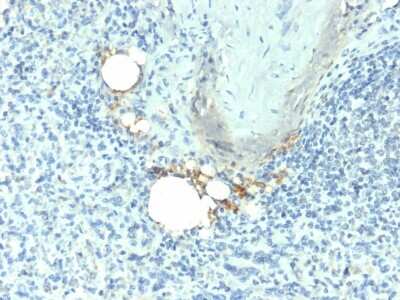 Immunohistochemistry-Paraffin: TRACP/PAP/ACP5 Antibody (ACP5/1070) [NBP2-45293]