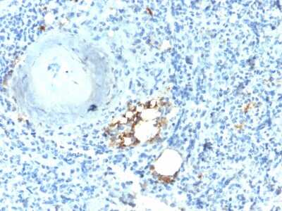 Immunohistochemistry-Paraffin: TRACP/PAP/ACP5 Antibody (ACP5/2336R) - Azide and BSA Free [NBP3-08700]