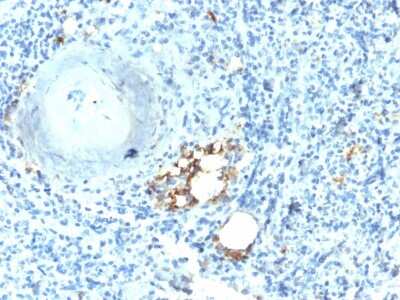 Immunohistochemistry-Paraffin: TRACP/PAP/ACP5 Antibody (ACP5/2336R) [NBP3-07651]