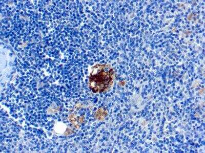 Immunohistochemistry-Paraffin: TRACP/PAP/ACP5 Antibody (SPM601) [NBP2-45294]