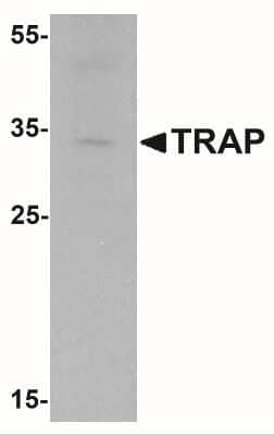 Western Blot: TRACP/PAP/ACP5 AntibodyBSA Free [NBP2-41178]