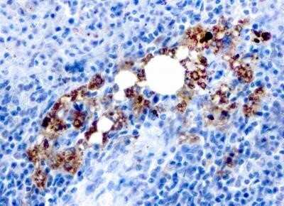 Immunohistochemistry-Paraffin: TRACP/PAP/ACP5 Antibody (rACP5/1070) - Azide and BSA Free [NBP2-75780]