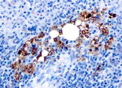 Immunohistochemistry-Paraffin: TRACP/PAP/ACP5 Antibody (rACP5/1070) [NBP2-75778]