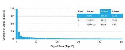 Protein Array: TRACP/PAP/ACP5 Antibody (rACP5/1070) [NBP2-75778]