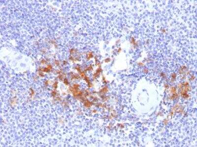 Immunohistochemistry-Paraffin: TRAF-1 Antibody (TRAF1/2770) - Azide and BSA Free [NBP2-79924]