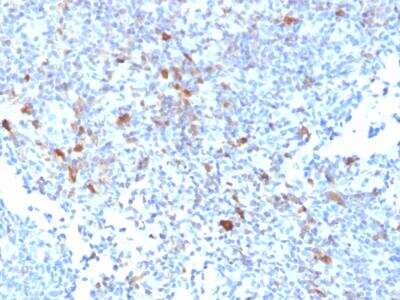 Immunohistochemistry-Paraffin: TRAF-1 Antibody (TRAF1/2770) - Azide and BSA Free [NBP2-79924]