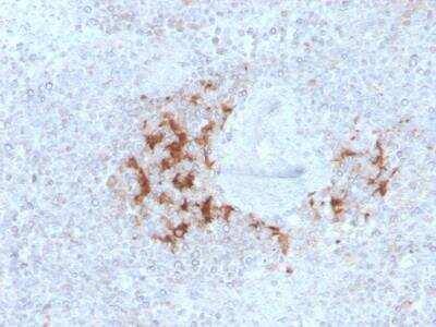 Immunohistochemistry-Paraffin: TRAF-1 Antibody (TRAF1/3298) - Azide and BSA Free [NBP2-79925]