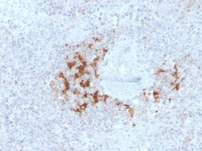 Immunohistochemistry-Paraffin: TRAF-1 Antibody (TRAF1/3298) [NBP2-79791]