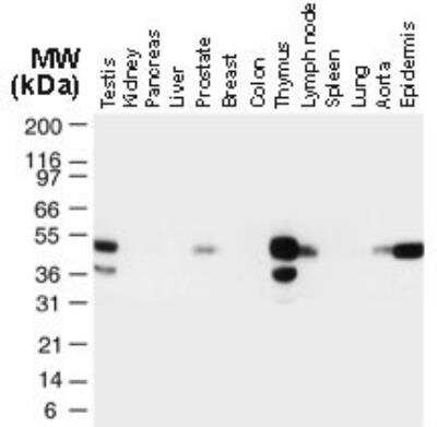 Western Blot: TRAF-1 Antibody [NB100-56170]