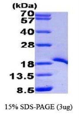 SDS-PAGE: Recombinant Human TRAF-1 His Protein [NBP1-44457]