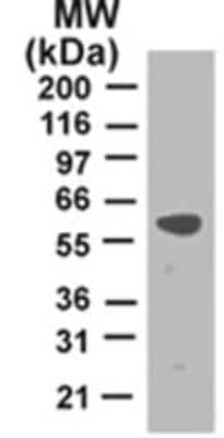 Western Blot: TRAF-2 Antibody (33A1293)BSA Free [NB100-56715]