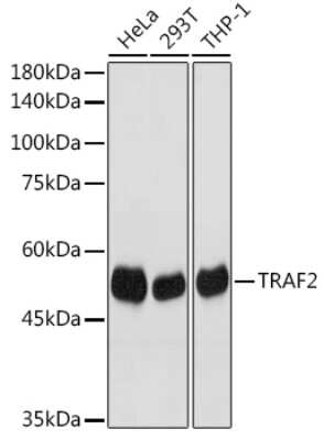 Western Blot: TRAF-2 Antibody (3S2A8) [NBP3-15682]