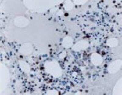 Immunohistochemistry: TRAF-2 Antibody [NB100-56172]