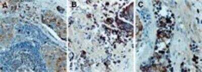 Immunohistochemistry-Paraffin: TRAF-2 Antibody [NB100-56173]