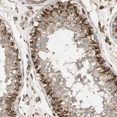 Immunohistochemistry-Paraffin: TRAF-2 Antibody [NBP1-86913]