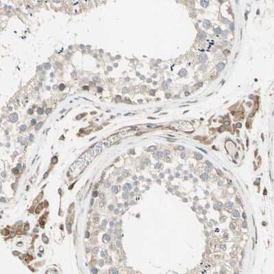 Immunohistochemistry-Paraffin: TRAF-2 Antibody [NBP1-86914]