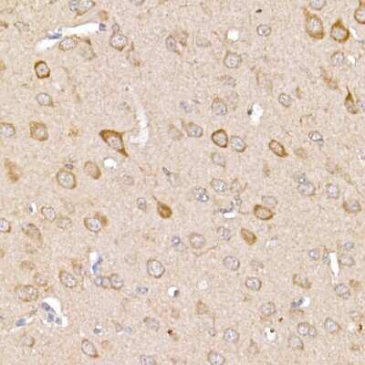 Immunohistochemistry-Paraffin: TRAF-2 Antibody - BSA Free [NBP3-03438]