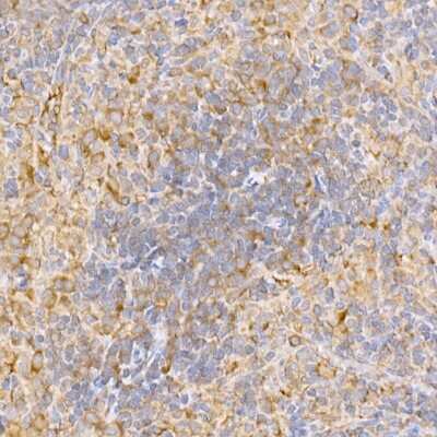 Immunohistochemistry-Paraffin: TRAF-2 Antibody - BSA Free [NBP3-03438]
