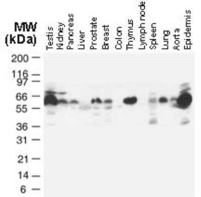 Western Blot: TRAF-2 Antibody [NB100-56173]