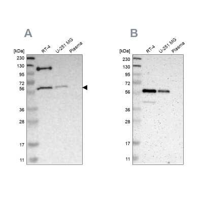 Western Blot: TRAF-2 Antibody [NBP1-86913]