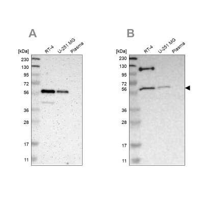 Western Blot: TRAF-2 Antibody [NBP1-86914]