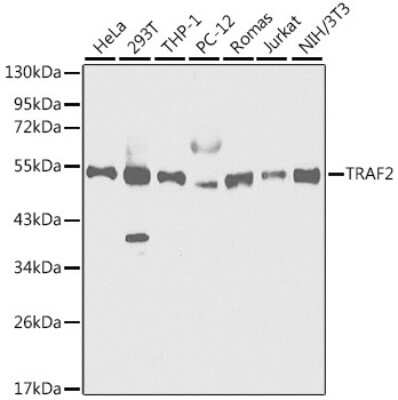 Western Blot: TRAF-2 AntibodyBSA Free [NBP3-03438]