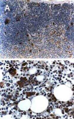 Immunohistochemistry-Paraffin: TRAF-5 Antibody [NB100-56178]