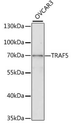 Western Blot: TRAF-5 AntibodyAzide and BSA Free [NBP2-93920]