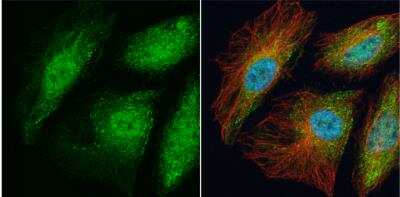 Immunocytochemistry/ Immunofluorescence: TRAF-6 Antibody [NBP1-33357]